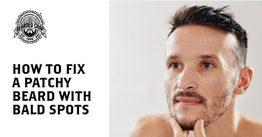 how to fix a patchy beard with bald spots